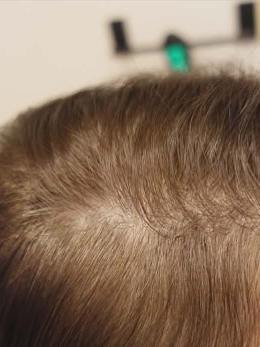 Before treatment